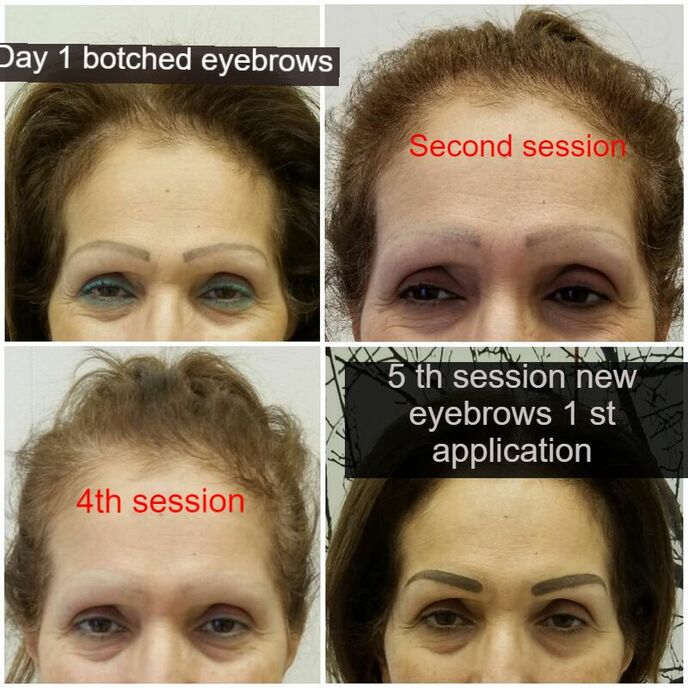 What pros and cons of powder eyebrow tattooing technique  Cocmetic tattoo