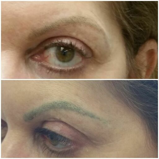 Eyebrow Tattoos: The Best Cosmetic Treatment For A More Youthful Appearance  - La Klinic