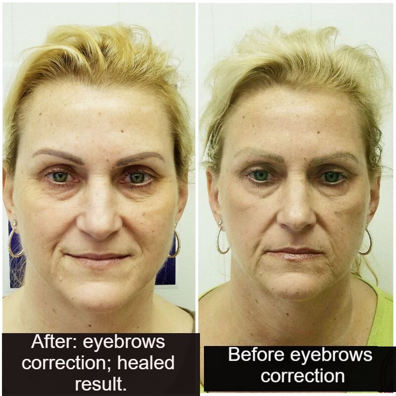 CoverupCorrection  Focus Beauty And Brows